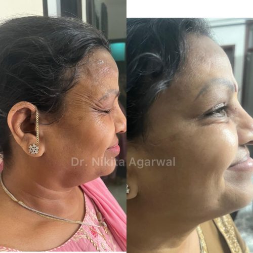 WhatsApp Image 2025-07-31 at 1.24.35 PM