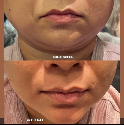 WhatsApp Image 2025-07-31 at 1.38.40 PM